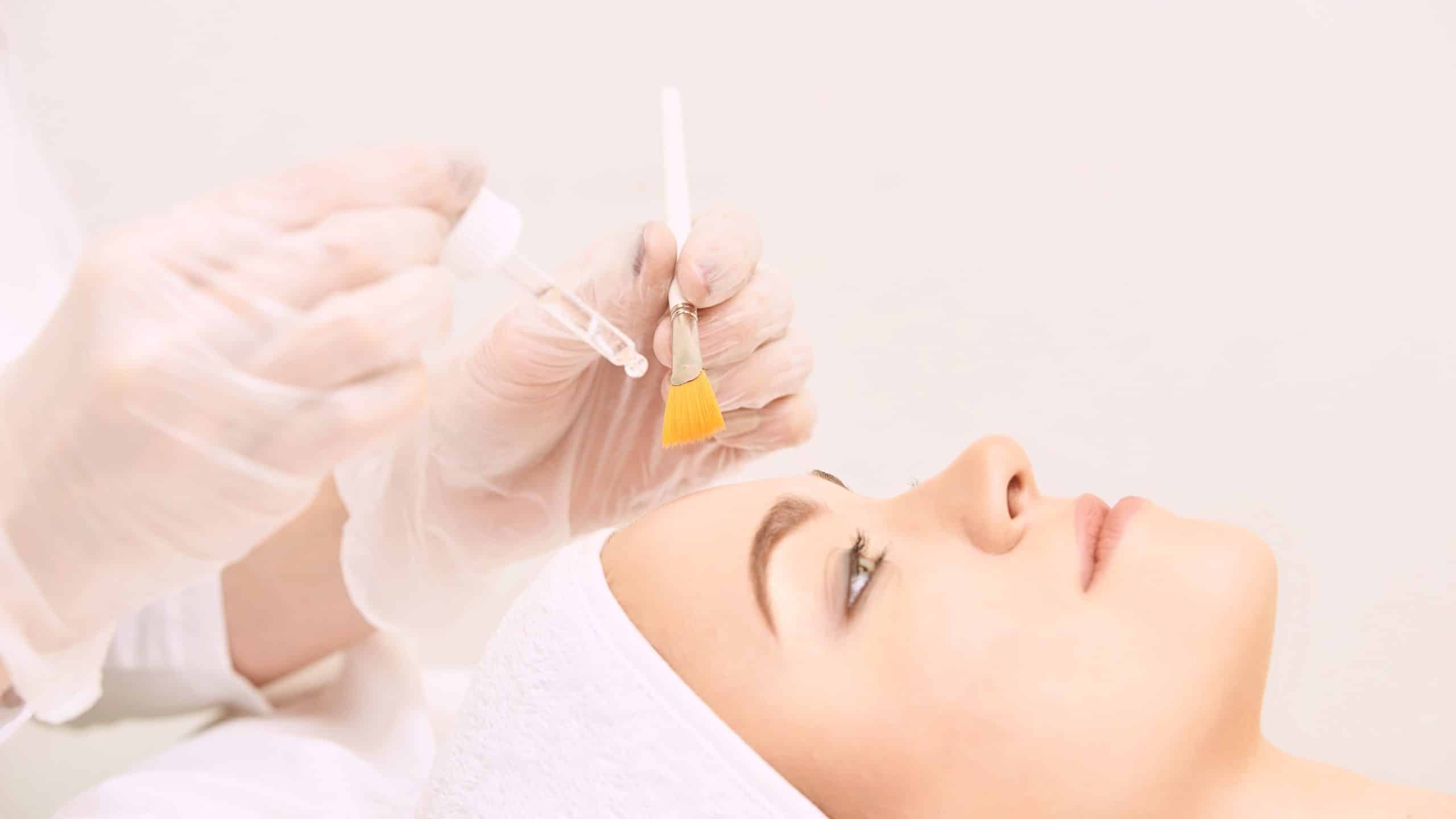 What Chemical Peel is The Best For Superficial Acne Pitted Scars