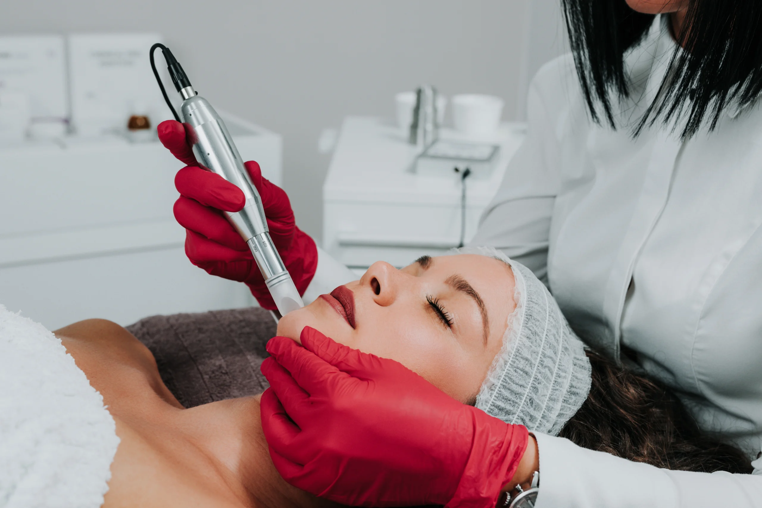 Microneedling in Overland Park, KS by Refresh Medical Spa