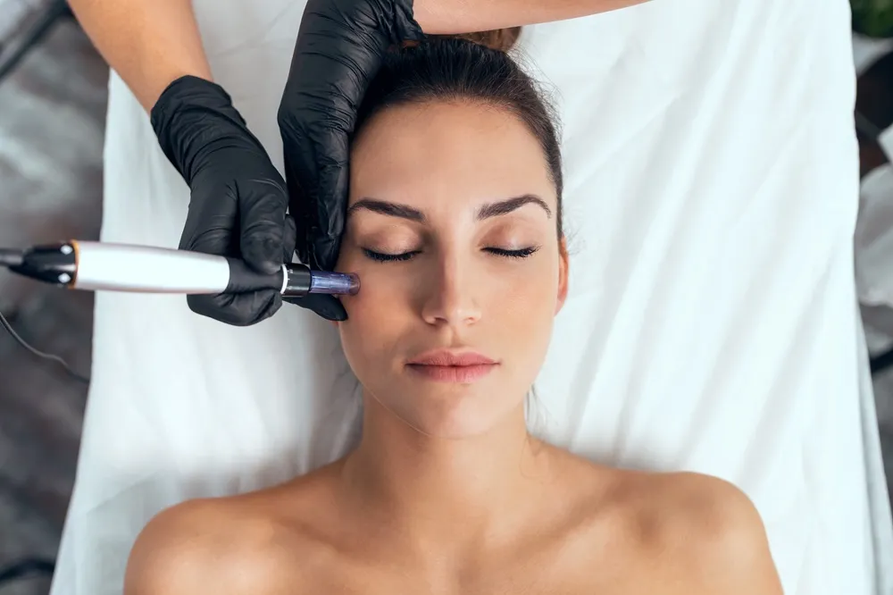 Microneedling by Refresh Medical Spa in Overland Park, KS