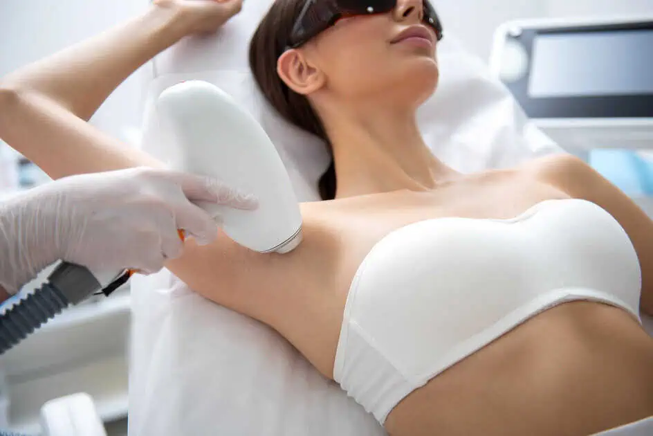 Laser Hair Removal
